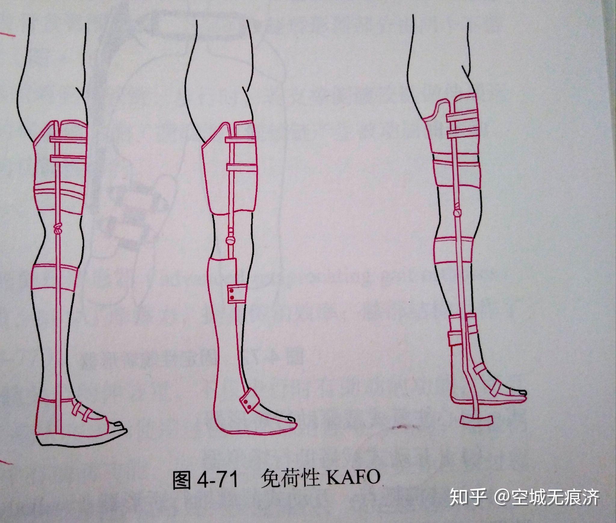 臨床康復工程學 假肢與矯形器的功能、設計與發展